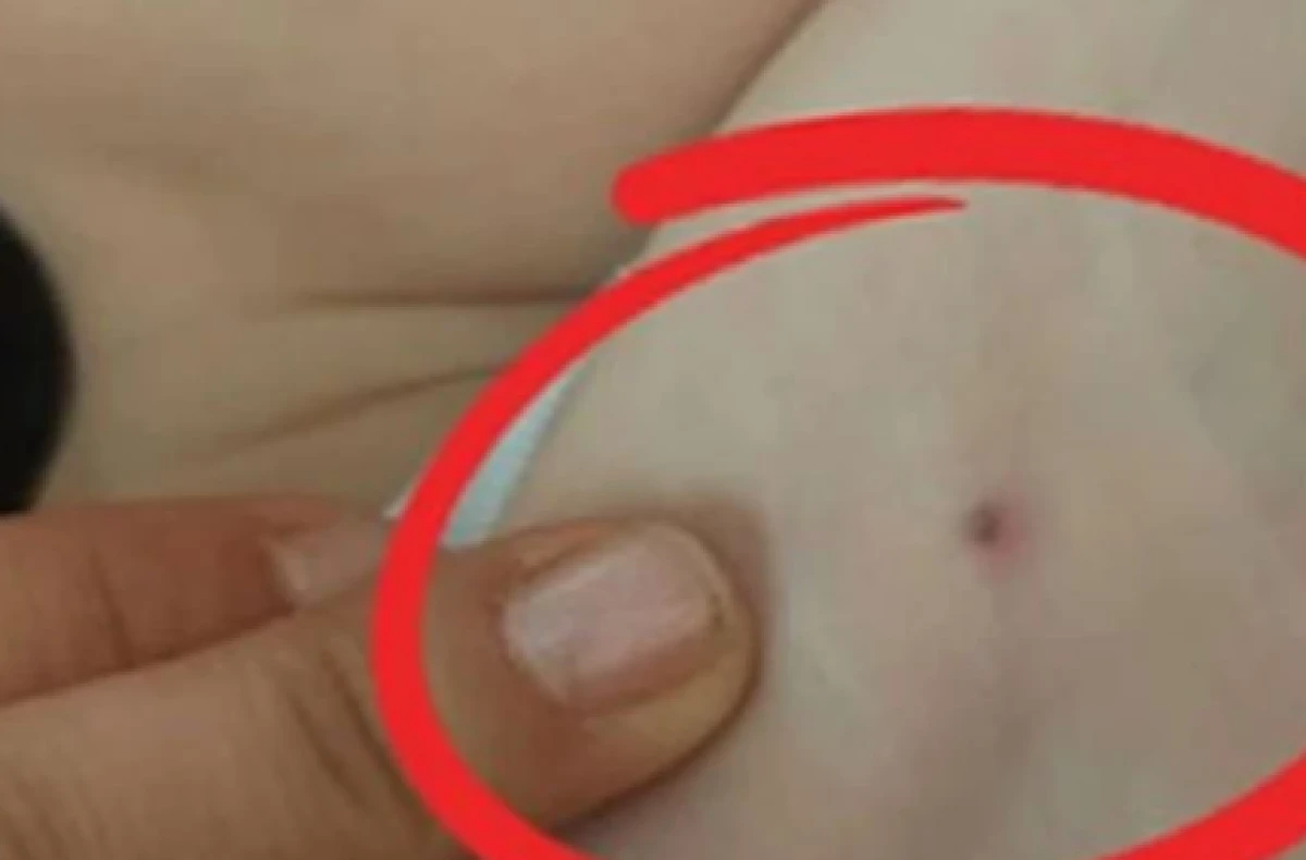 Aileler Dikkat! Parkta Oynayan Çocuğa Kene Yapıştı