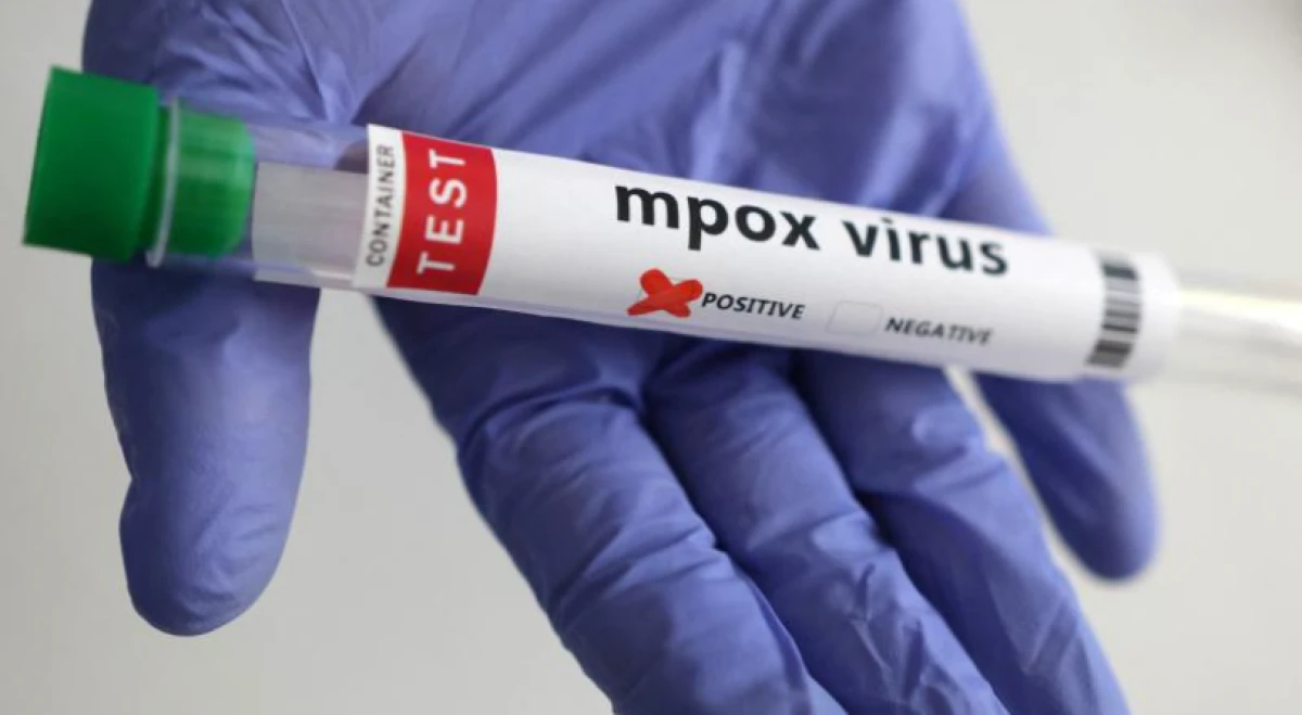 Maymun çiçeği virüsünün yeni bir türü tespit edildi