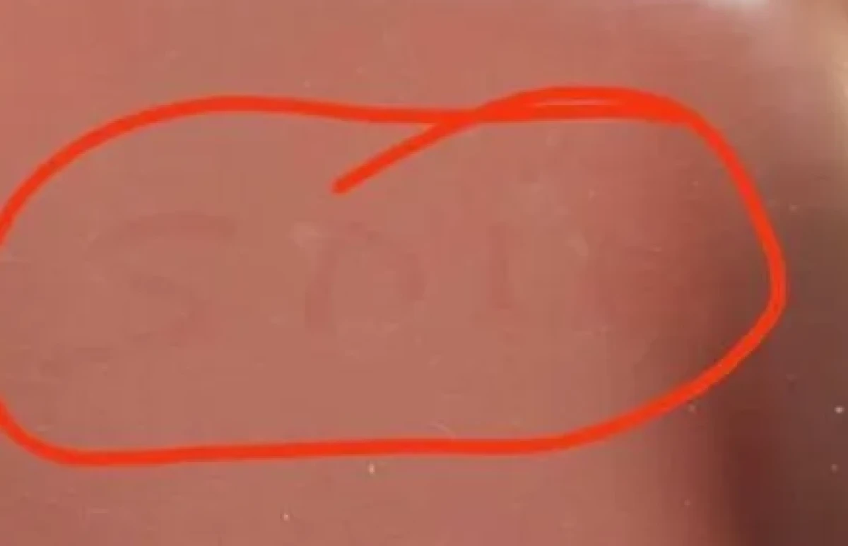 SDÜ Hastanesi’nde tepki çeken görüntü